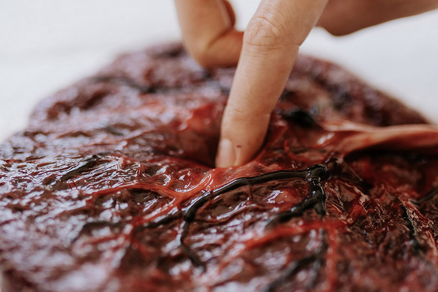 O que se faz com a placenta após o parto?